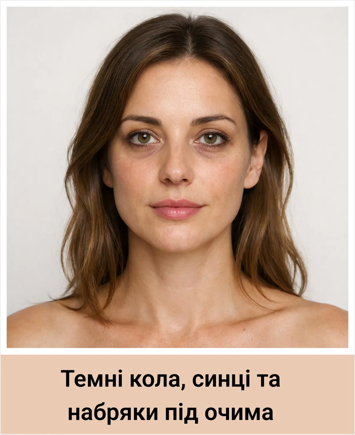 Темні кола, синці, набряки під очима