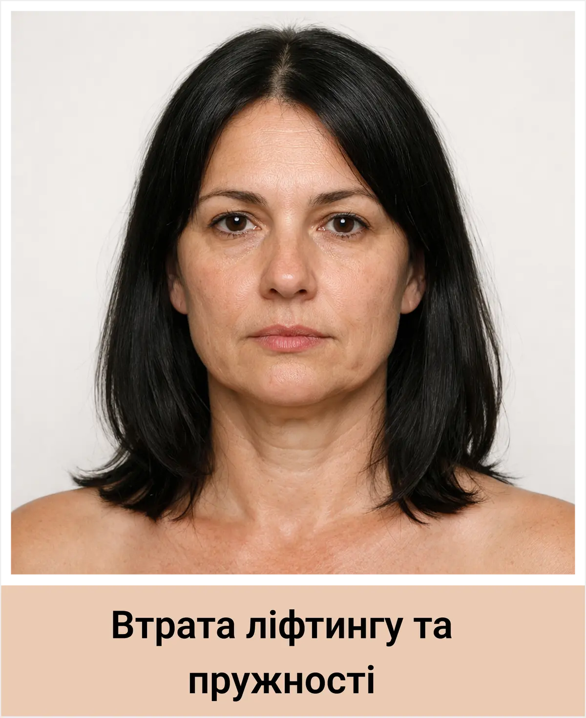 Втрата ліфтингу та пружності