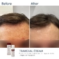 Освітлюючий крем проти пігментації Braderm Tramexal Cream 30 ml