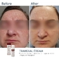Освітлюючий крем проти пігментації Braderm Tramexal Cream 30 ml