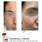 Освітлюючий крем проти пігментації Braderm Tramexal Cream 30 ml