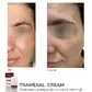Освітлюючий крем проти пігментації Braderm Tramexal Cream 30 ml