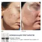 Активний протизапальний крем з бензоїл пероксидом 4% Braderm - Kurac Cream (Курак крем) 30 ml