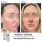 Заспокійливий крем для чутливої шкіри Braderm Rosac Cream (Розак Крем) 30 ml