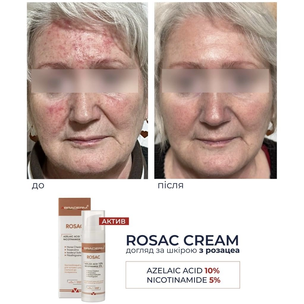 Заспокійливий крем для чутливої шкіри Braderm Rosac Cream (Розак Крем) 30 ml