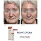 Заспокійливий крем для чутливої шкіри Braderm Rosac Cream (Розак Крем) 30 ml