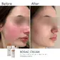 Заспокійливий крем для чутливої шкіри Braderm Rosac Cream (Розак Крем) 30 ml