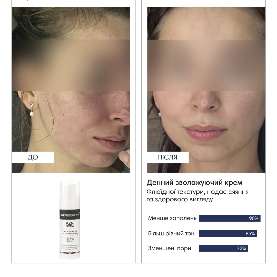 Сонцезахисний крем з протизапальним ефектом Braderm Azn Cream 30 ml