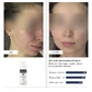 Сонцезахисний крем з протизапальним ефектом Braderm Azn Cream 30 ml