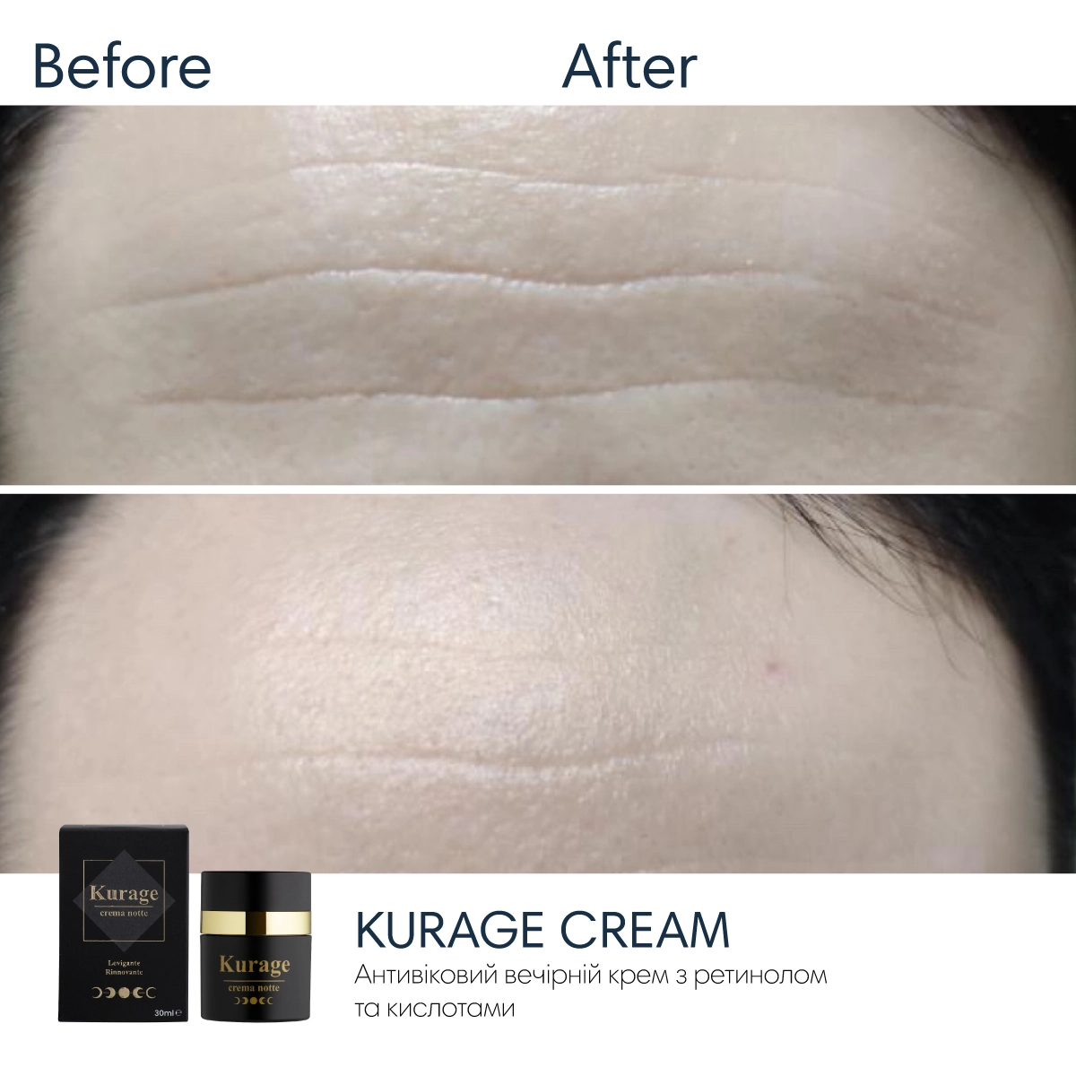 Крем-пілінг з ретинолом та кислотами Braderm Kurage Cream 30 ml