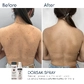 Активний протизапальний спрей з Бензоїл пероксидом 6% Braderm Dorsak Spray (Дорсак спрей) 100 ml