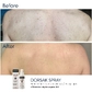 Активний протизапальний спрей з Бензоїл пероксидом 6% Braderm Dorsak Spray (Дорсак спрей) 100 ml