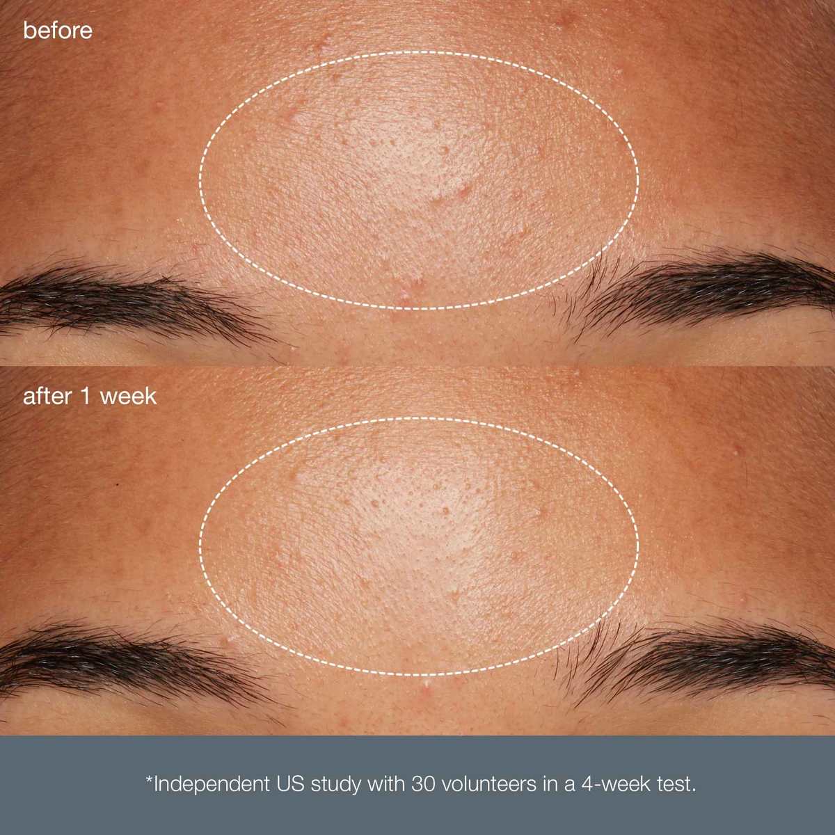 Щоденний мікрофоліант Dermalogica Daily Microfoliant, 13г