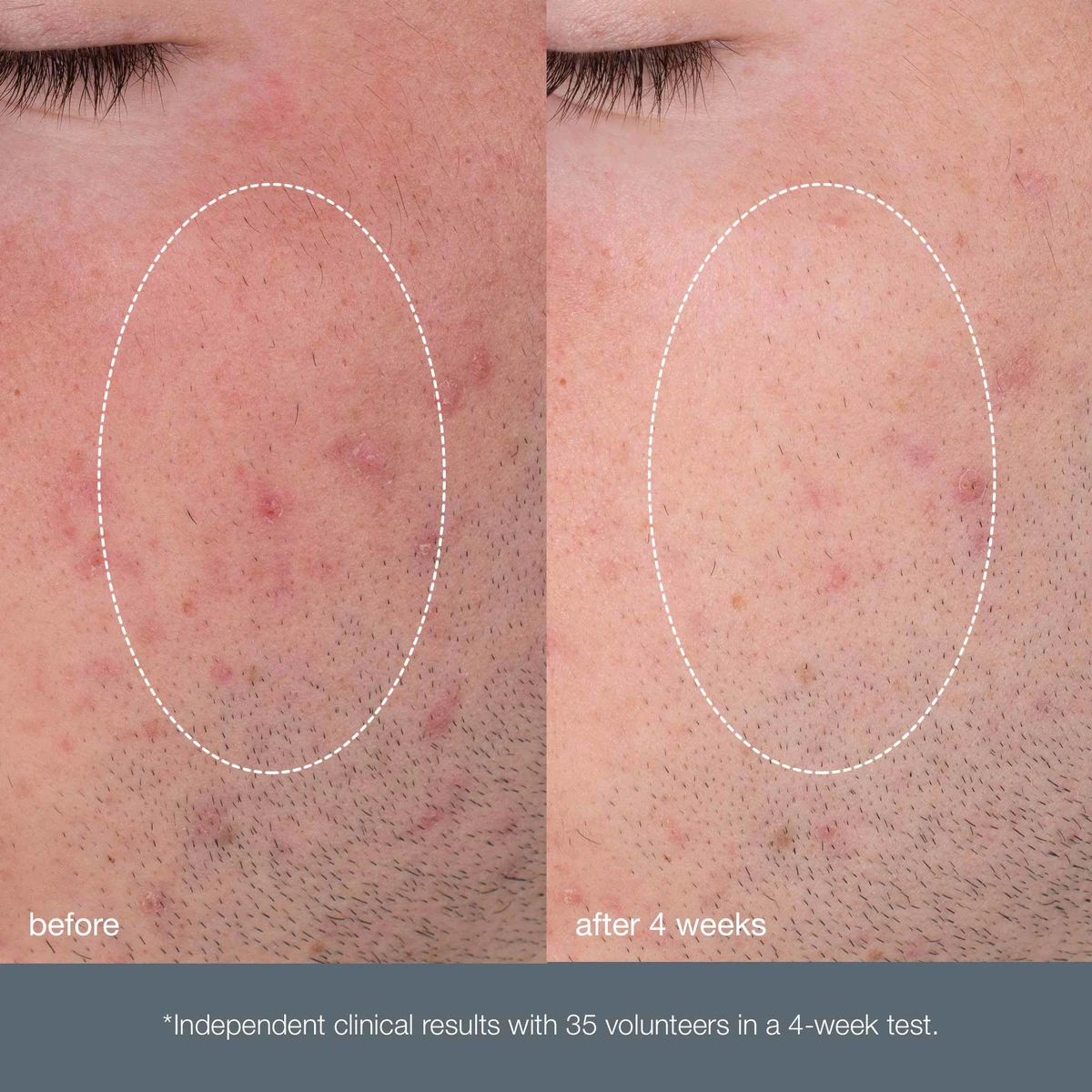 Щоденний мікрофоліант Dermalogica Daily Microfoliant, 13г